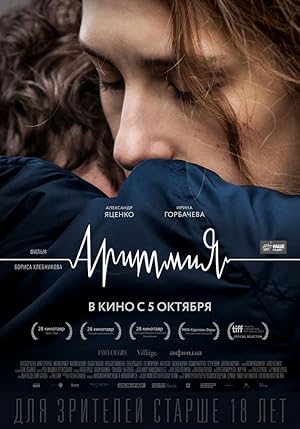 Aritmiya izle